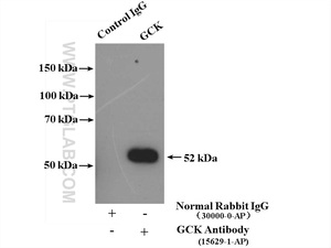 Anti-GCK Rabbit Polyclonal Antibody