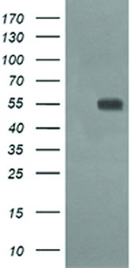 Anti-CD33 Mouse Monoclonal Antibody [clone: OTI1E4]