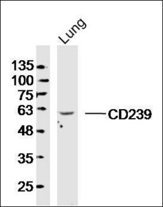 Western blot analysis of human Lovo lysates (Lane 1) using CD239 antibody.