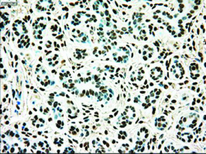 Anti-TYRO3 Mouse Monoclonal Antibody [clone: OTI4C8]