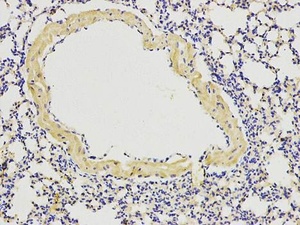 Immunohistochemical analysis of formalin-fixed paraffin embedded mouse lung tissue using ATG13 antibody.