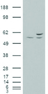 Anti-AKT3 Mouse Monoclonal Antibody [clone: OTI9H8]