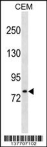 Anti-LONRF3 Rabbit Polyclonal Antibody (AP (Alkaline Phosphatase))