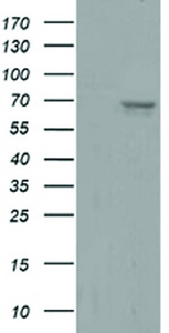 Anti-AFP Mouse Monoclonal Antibody [clone: OTI2A6]