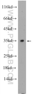 Anti-C2orf51 Rabbit Polyclonal Antibody