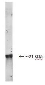 Whole HeLa cell lysate stained with mouse anti-DJ1 antibody. The antibody recognizes the ~21 kDa protein.