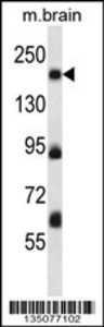 Anti-MAP4K4 Rabbit Polyclonal Antibody (FITC (Fluorescein Isothiocyanate))
