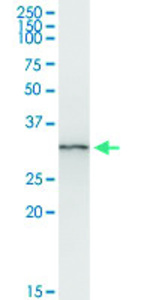 Anti-ANXA3 Polyclonal Antibody Pair