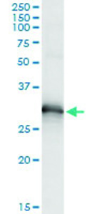 Anti-HOXB9 Antibody Pair