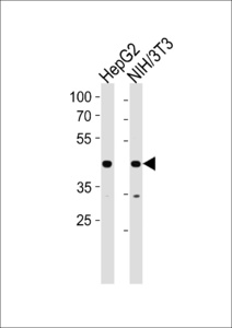 Anti-NR2F2 Rabbit Polyclonal Antibody (APC (Allophycocyanin))