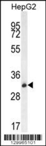 Anti-OR4K5 Rabbit Polyclonal Antibody (PE (Phycoerythrin))