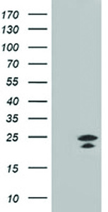 Anti-FGF21 Mouse Monoclonal Antibody [clone: OTI1H5]