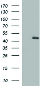 Anti-TGFB1 Mouse Monoclonal Antibody [clone: OTI2B5]