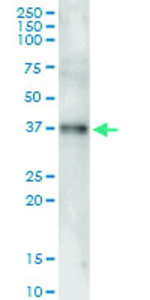 Anti-POMC Polyclonal Antibody Pair