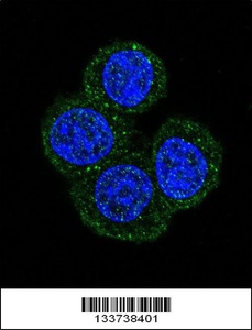 Anti-MEN1 Rabbit Polyclonal Antibody (HRP (Horseradish Peroxidase))