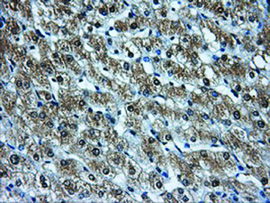 Anti-HDAC10 Mouse Monoclonal Antibody [clone: OTI7C3]