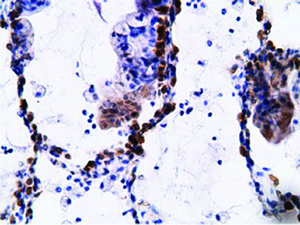 Anti-EPHX2 Mouse Monoclonal Antibody [clone: OTI1H5]