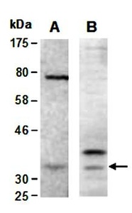 Western blot analysis of total cell extracts from mouse mammary gland using CNN1 antibody