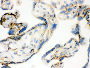 Anti-TGM2 Rabbit Polyclonal Antibody