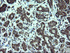 Anti-STK38L Mouse Monoclonal Antibody [clone: OTI4D8]