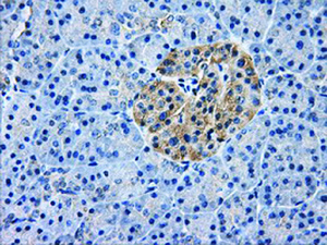 Anti-AKR1A1 Mouse Monoclonal Antibody [clone: OTI4G2]