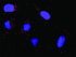Anti-PTK2 + ITGAV Polyclonal Antibody Pair