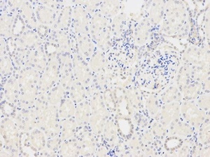 Immunohistochemical analysis of formalin-fixed and paraffin-embedded human kidney tissue using TPM3 antibody (primary antibody dilution at 1:200)