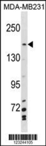 Anti-MYBBP1A Rabbit Polyclonal Antibody (Biotin)