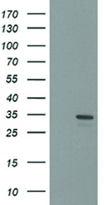 Anti-HDHD2 Mouse Monoclonal Antibody [clone: OTI3H8]