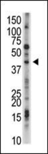 Anti-USP12 Rabbit Polyclonal Antibody (PE (Phycoerythrin))