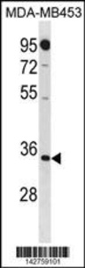 Anti-MTAP Rabbit Polyclonal Antibody (FITC (Fluorescein Isothiocyanate))
