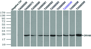 Anti-CRYAB Mouse Monoclonal Antibody [clone: OTI1G1]
