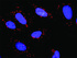Anti-TRAF2 + MAP3K1 Antibody Pair