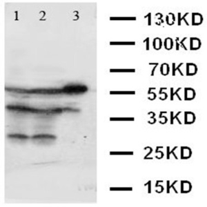 Western blot analysis of Lane 1: SMMC Cell Lysate, Lane 2: HELA Cell Lysate, Lane 3: A431 Cell Lysate using XIAP antibody.