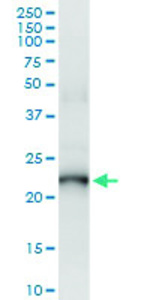 Anti-PDE4DIP Polyclonal Antibody Pair