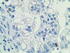 Anti-HDHD2 Mouse Monoclonal Antibody [clone: OTI4G3]