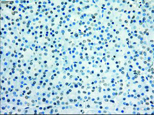 Anti-KDM4C Mouse Monoclonal Antibody [clone: OTI4B1]