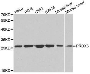 Western blot analysis of extracts of various cell lines using PRDX6 antibody