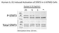 Human Recombinant IL31 (from E. coli)