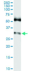 Anti-SNAI1 Polyclonal Antibody Pair