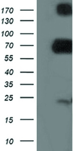 Anti-DPP3 Mouse Monoclonal Antibody [clone: OTI1E7]