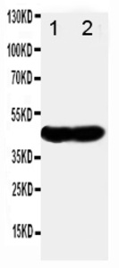 Anti-NDRG1 Rabbit Polyclonal Antibody