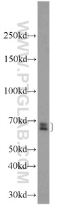 Anti-GPATCH2 Rabbit Polyclonal Antibody