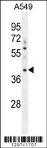 Anti-MYBPHL Rabbit Polyclonal Antibody (HRP (Horseradish Peroxidase))