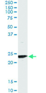 Anti-UBE2T Antibody Pair