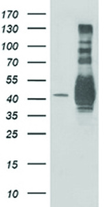 Anti-MAPRE2 Mouse Monoclonal Antibody [clone: OTI3C7]