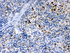 Anti-TNF Receptor II Rabbit Polyclonal Antibody