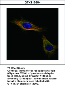 Anti-TPX2 Rabbit Polyclonal Antibody