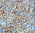 Anti-LRP8 Rabbit Polyclonal Antibody (HRP (Horseradish Peroxidase))
