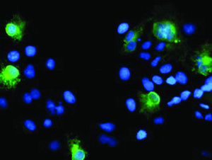 Anti-SPINT1 Mouse Monoclonal Antibody [clone: OTI4E1]